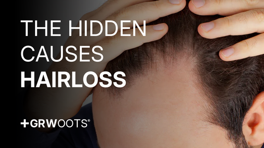 hairloss hidden causes
