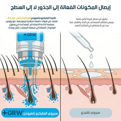 GRWOOTS® علاج بالحقن المجهري لتساقط الشعر ودعم نمو شعر أقوى وأكثر كثافة